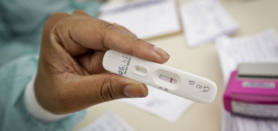 Anvisa aprova uso e comercialização de autoteste para Covid-19